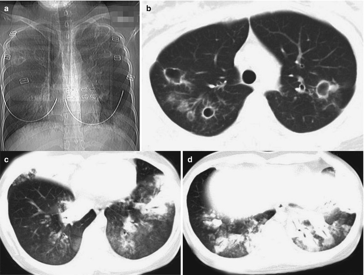 Fig. 22.25