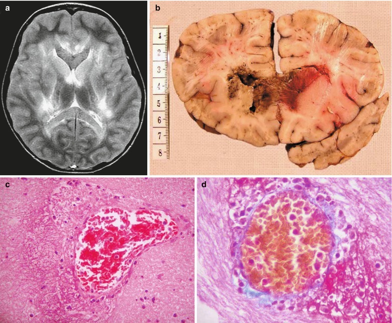 Fig. 22.5