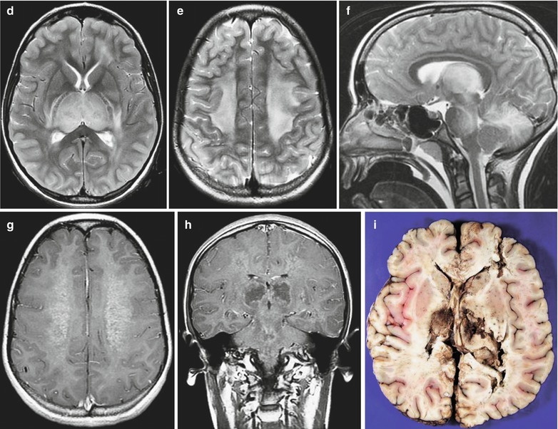 Fig. 22.4