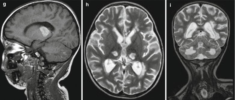 Fig. 22.3