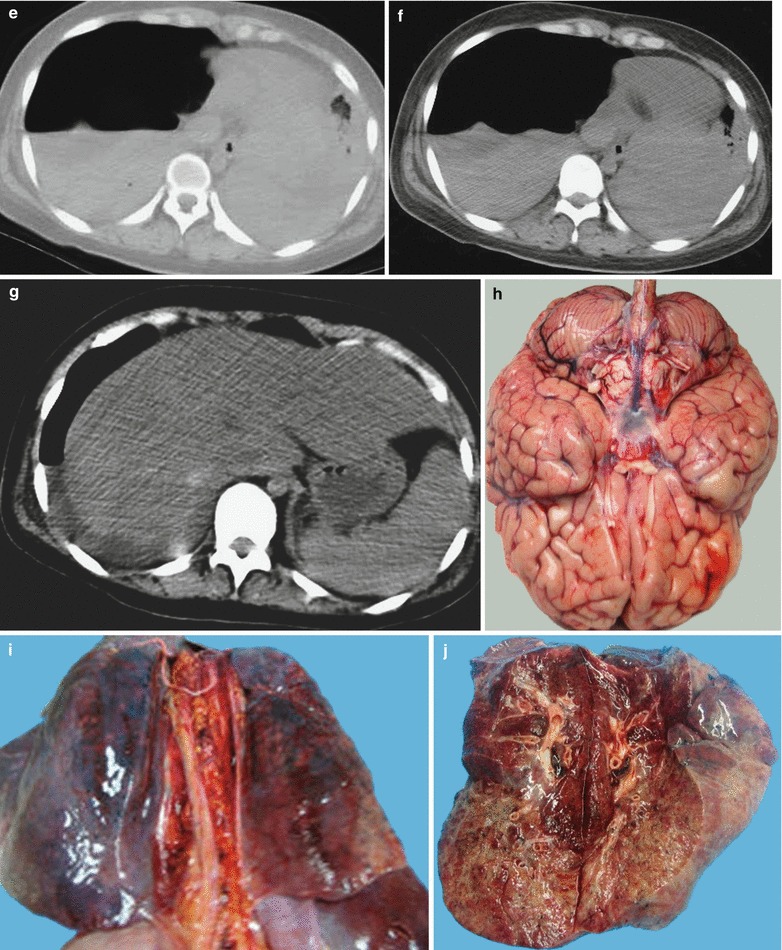 Fig. 22.32