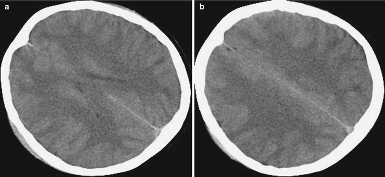 Fig. 22.2