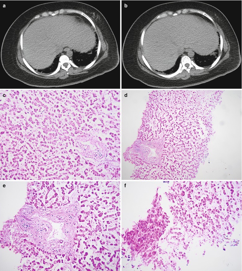 Fig. 22.30