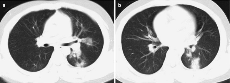 Fig. 22.12