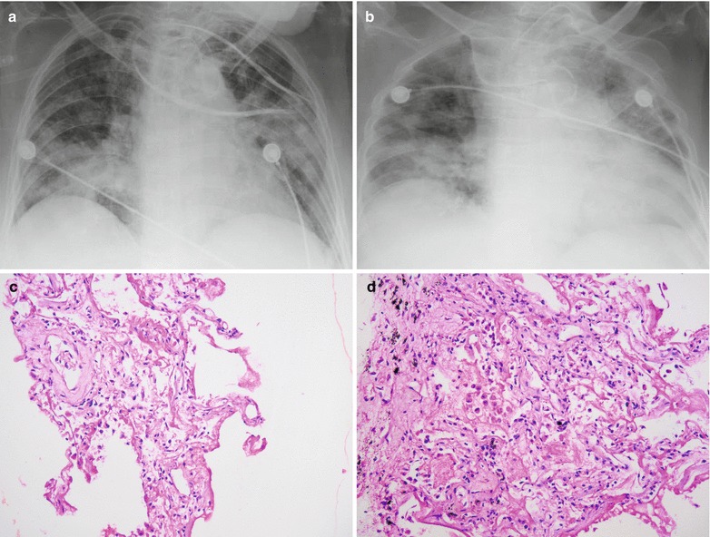 Fig. 22.29