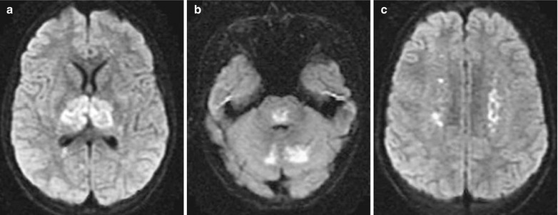 Fig. 22.4