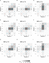 Pairwise interreader agreement matrices for functional tumor volume
(FTV) show estimation categorization at three MRI time points as follows:
(A–C) pretreatment (T0), (D–F) early treatment (T1), and
(G–I) inter-regimen (T2). Data within the matrices are numbers of
participants, and the gray scale represents the proportion of participants.
Agreements are indicated in red text and disagreements are indicated in blue
text, per category (CTG).