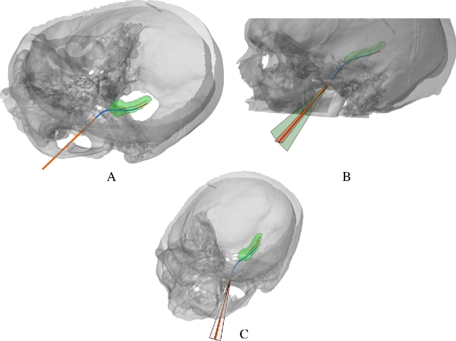 FIGURE 4.