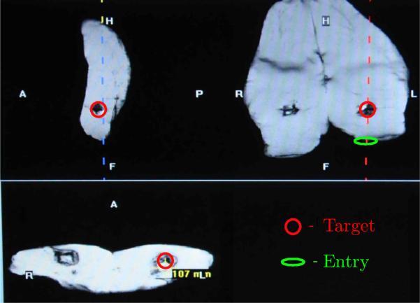 Figure 16