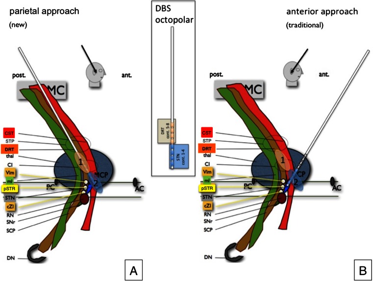 Fig. 1