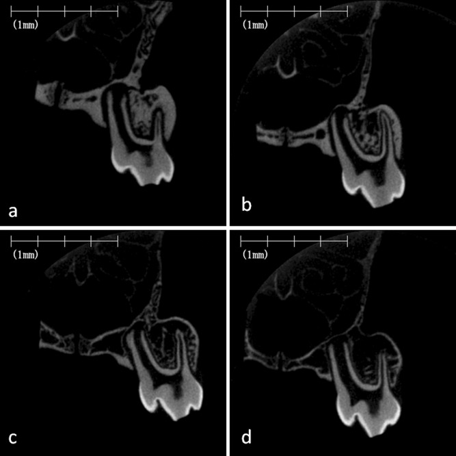 Figure 3. Micro–computed tomography images of rat maxillary alveolar bone and hard plate. Representative images of frontal cross-section of the hard plate in the maxillary first molar region of the rat fed on the normal-calcium (a, hard; b, soft) and low-calcium (c, hard; d, soft) diets.