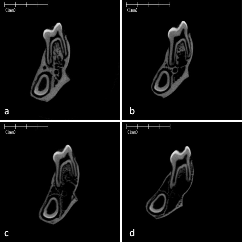 Figure 4. Micro–computed tomography images of rat mandibular alveolar bone. Representative images of the frontal cross-section of the furcation region of the mandibular first molar in the rat fed on the normal-calcium (a, hard; b, soft) and low-calcium (c, hard; d, soft) diets.