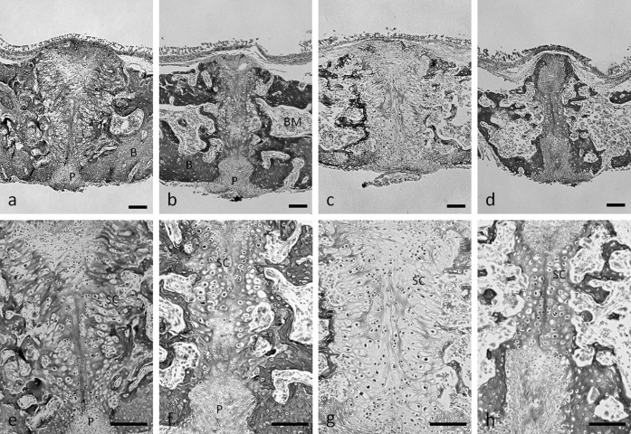 Figure 7. Midpalatal suture bone and cartilage. Hematoxylin and eosin staining of frontal sections of midpalatal sutures of rats fed the normal-calcium (a, hard; b, soft) and low-calcium (c, hard; d, soft) diets. e–h are higher magnification of a–d, respectively. P indicates periosteum within the oral region of the midpalatal suture; B, bone; BM, bone marrow; SC, suture cartilage. Bar  =  100 µm.