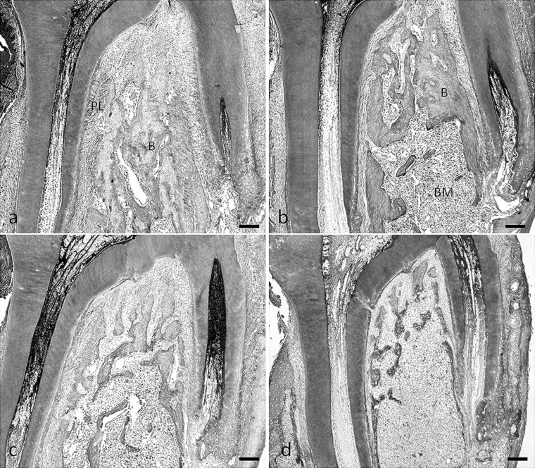 Figure 6. Photomicrographs of tissue stained with hematoxylin and eosin illustrating the furcation region of the mandibular first molar in the rats fed the normal-calcium (a, hard; b, soft) and low-calcium (c, hard; d, soft) diets. B indicates bone; BM, bone marrow; PL, periodontal ligament area. Bar  =  100 µm.