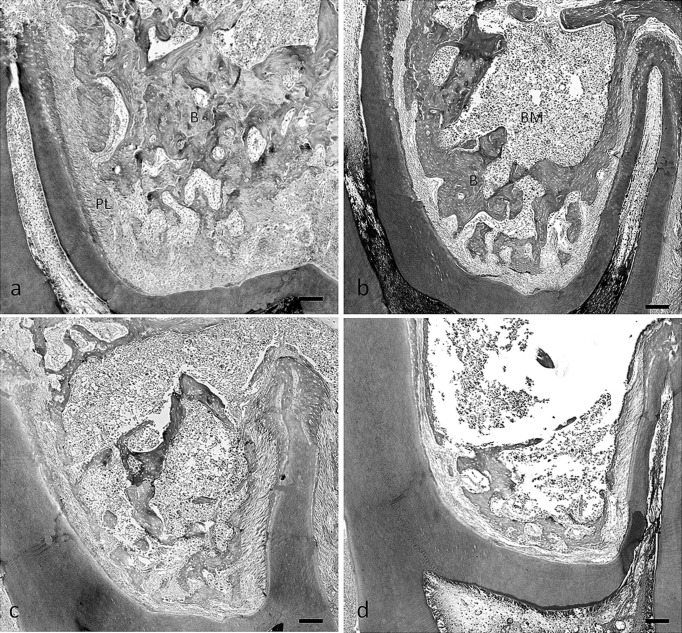 Figure 5. Photomicrographs of tissue stained with hematoxylin and eosin, illustrating the furcation region of the maxillary first molar in rats fed the normal-calcium (a, hard; b, soft) and low-calcium (c, hard; d, soft) diets. B indicates bone; BM, bone marrow; PL, periodontal ligament area. Bar  =  100 µm.