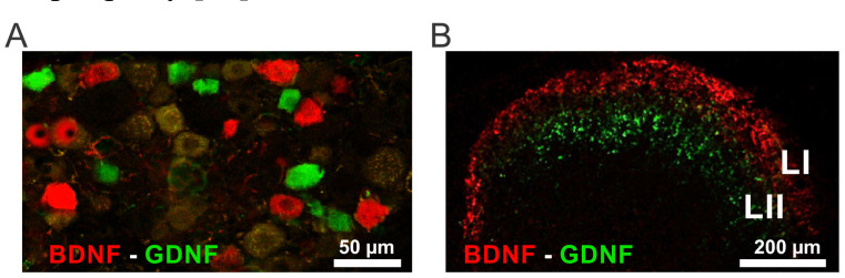 Fig. (1)