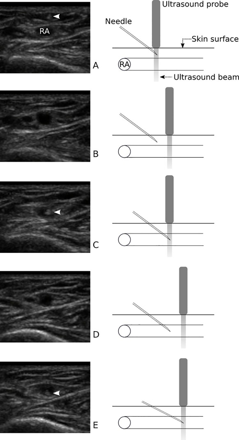 Fig 2