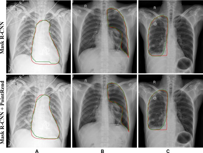 Results from Mask region-based convolutional neural network (R-CNN) to Mask R-CNN Point-based Rendering (PointRend) in (A) cardiomegaly,(B) pneumothorax, and (C) pleural effusion detection. Red lines indicate ground truth labels; green lines are from the models.