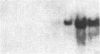 137