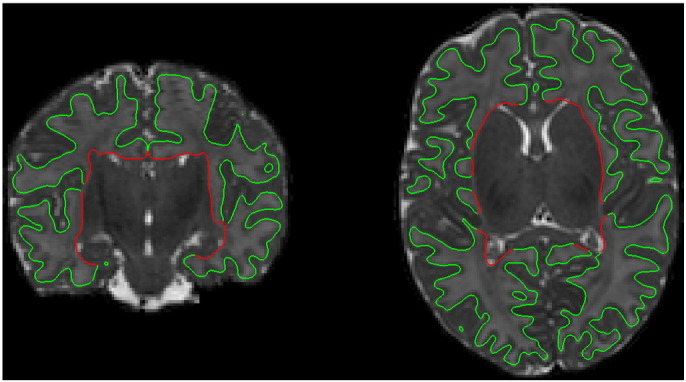 Fig. 7