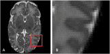 Fig. 4