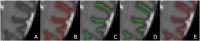 Fig. 6
