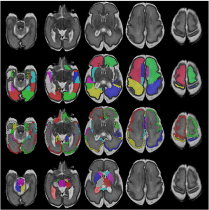 Fig. 1