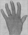 183