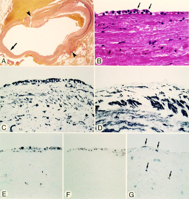 Figure 1  