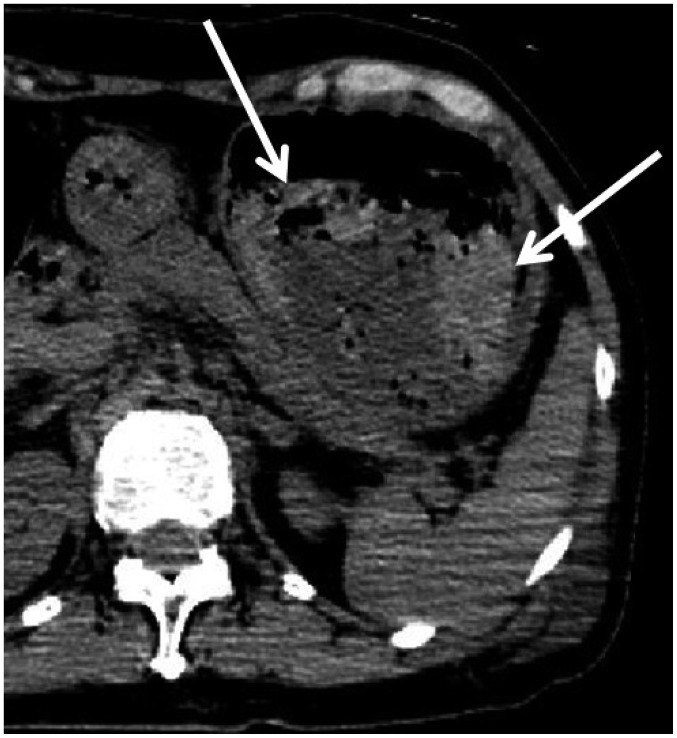 Fig. 8