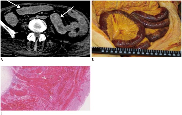 Fig. 11