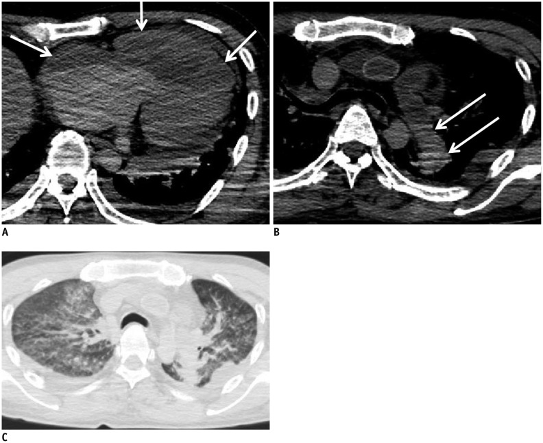 Fig. 15