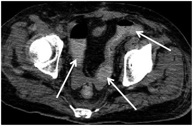 Fig. 9