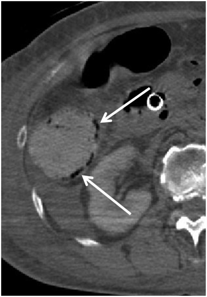 Fig. 14