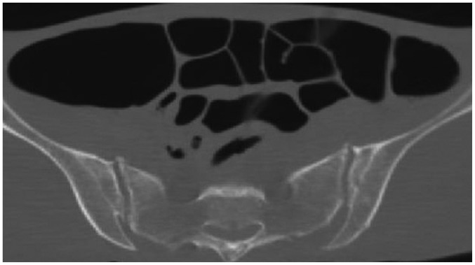 Fig. 12