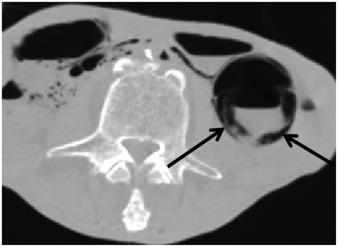 Fig. 13