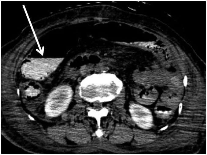 Fig. 10