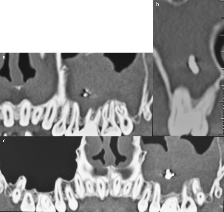 Figure 2 a, b, c