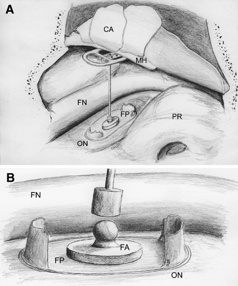 FIG. 1