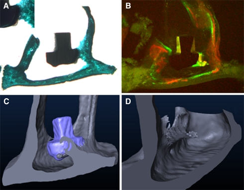 FIG. 3