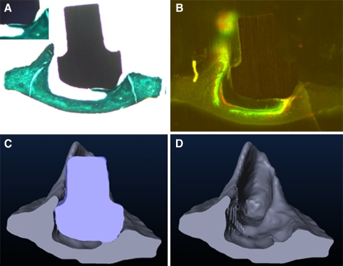 FIG. 4