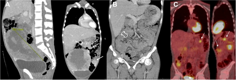 Fig. 2