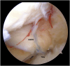 Fig 13