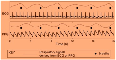 graphic file with name sensors-19-03030-i004.jpg