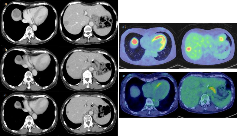 Fig. 2