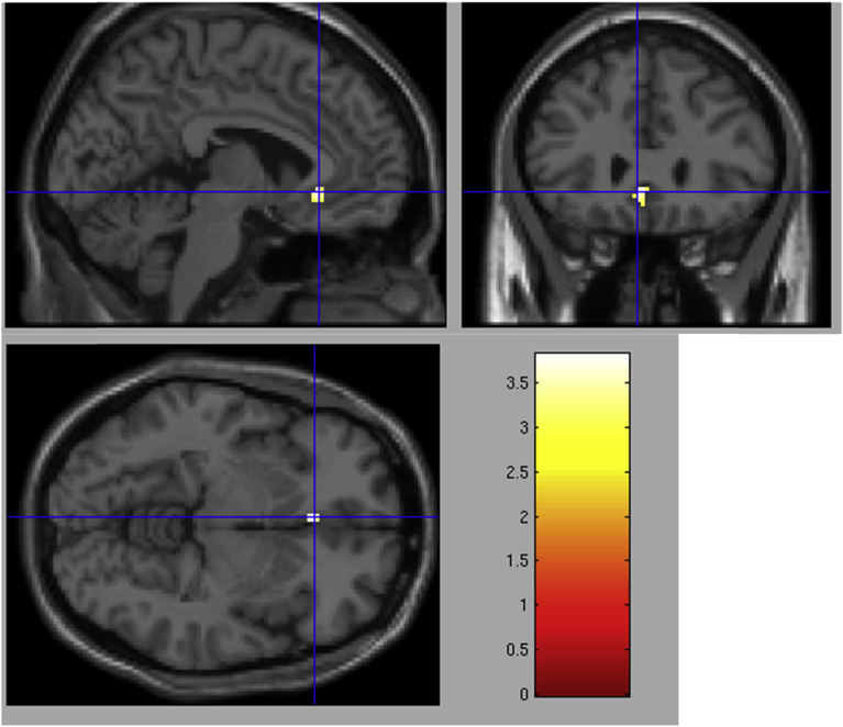 Fig. 1