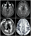 Figure 20