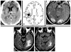 Figure 22