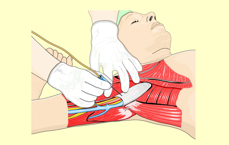 graphic file with name 6376_9_De_15_Fig5_HTML.jpg