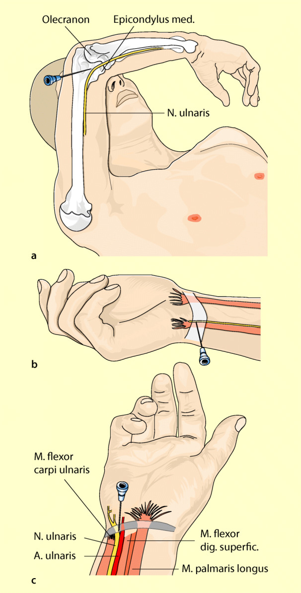 graphic file with name 6376_9_De_15_Fig11_HTML.jpg